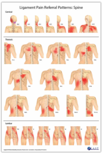 Ligament Pain Referral Patterns, Robert Libbey RMT